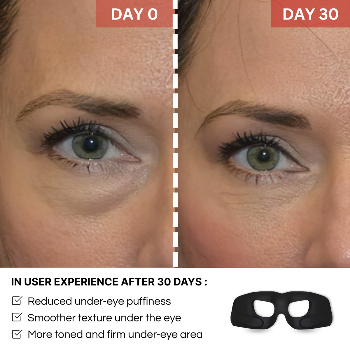 REVYLIFT™ EMS EYE MASK
