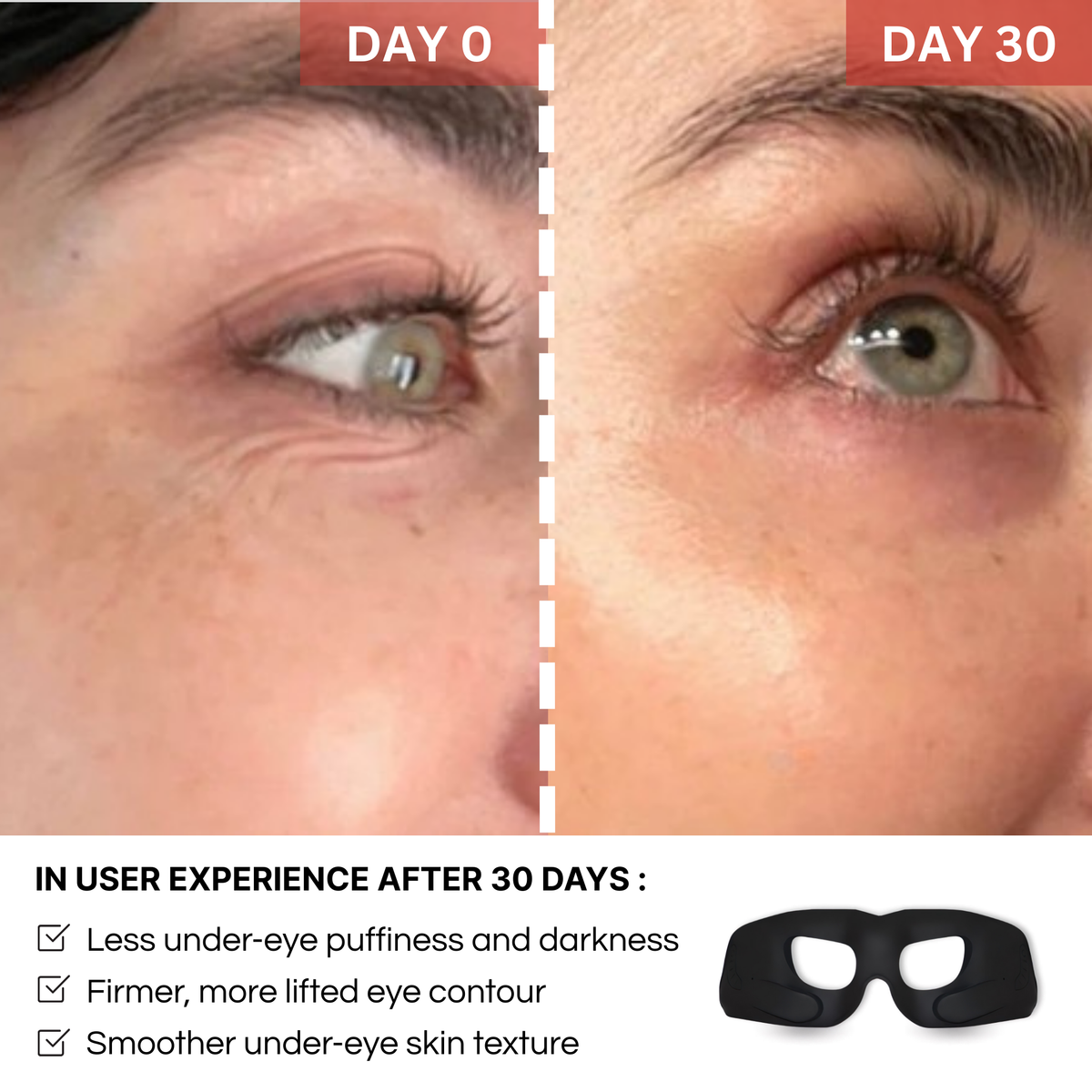 REVYLIFT™ EMS EYE MASK